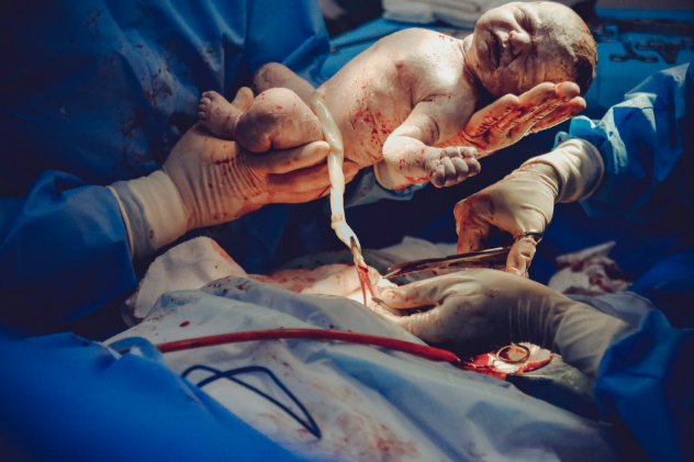 A Review on Natural Childbirth and the Risks Involved